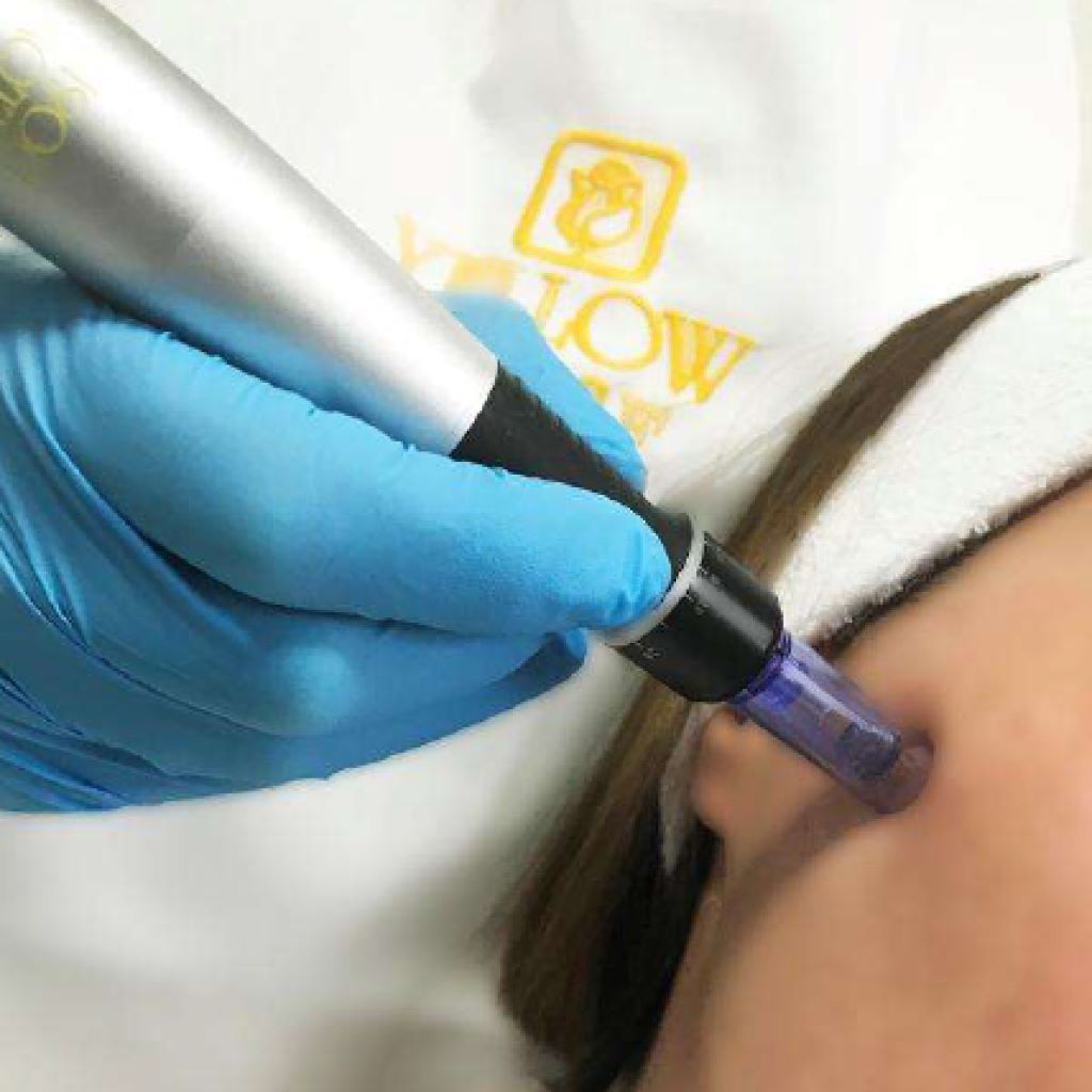 yellow-rose-skoleni-derma-pen